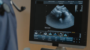 Screen with the image of a pet ultrasound